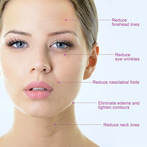 Woman with annotations for reducing forehead lines, eye wrinkles, nasolabial folds, edema, and neck lines.